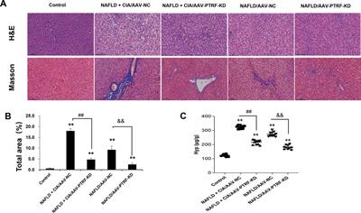 Non-alcoholic fatty liver disease combined with rheumatoid arthritis exacerbates liver fibrosis by stimulating co-localization of PTRF and TLR4 in rats